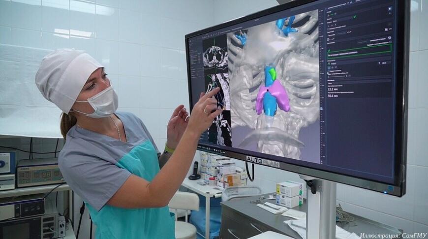 Врачи СамГМУ провели операцию на челюсти с применением 3D-печатного эндопротеза