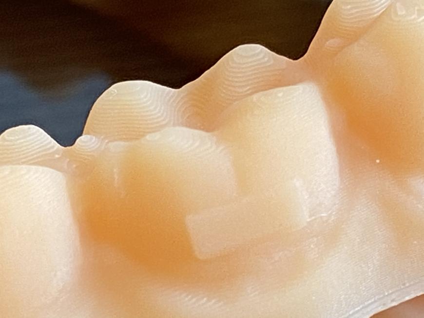 Мастер-модели из Hardlight dental skin