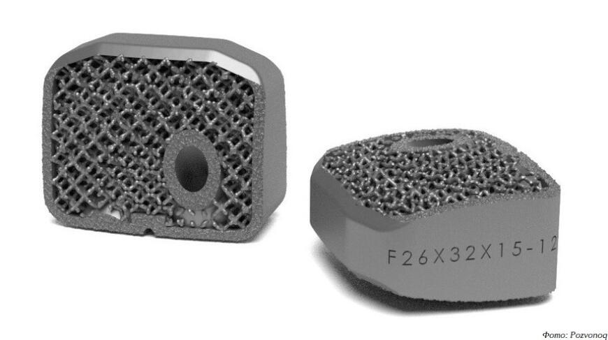 Компания Pozvonoq наладит производство 3D-печатных межпозвоночных кейджей