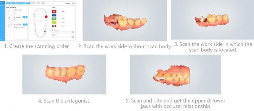 Обзор: Интраоральные 3D-сканеры