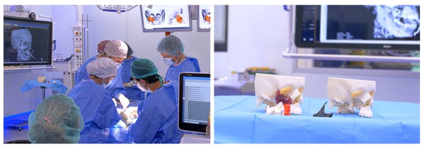 Детская больница SJD Barcelona печатает анатомические модели для планирования и моделирования сложных операций