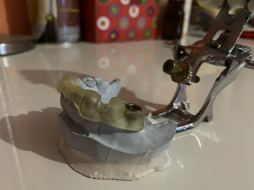 Хирургический шаблон из фотополимера Harz labs Dental yellow на Form2.