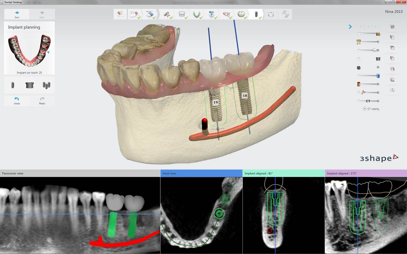 3d Shape Dental программа