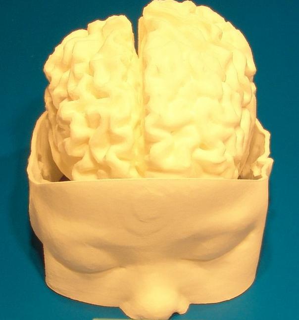 3D-печатная модель мозга ребенка (фотография предоставлена Джорджем Висенте Лопесом да Сильва)