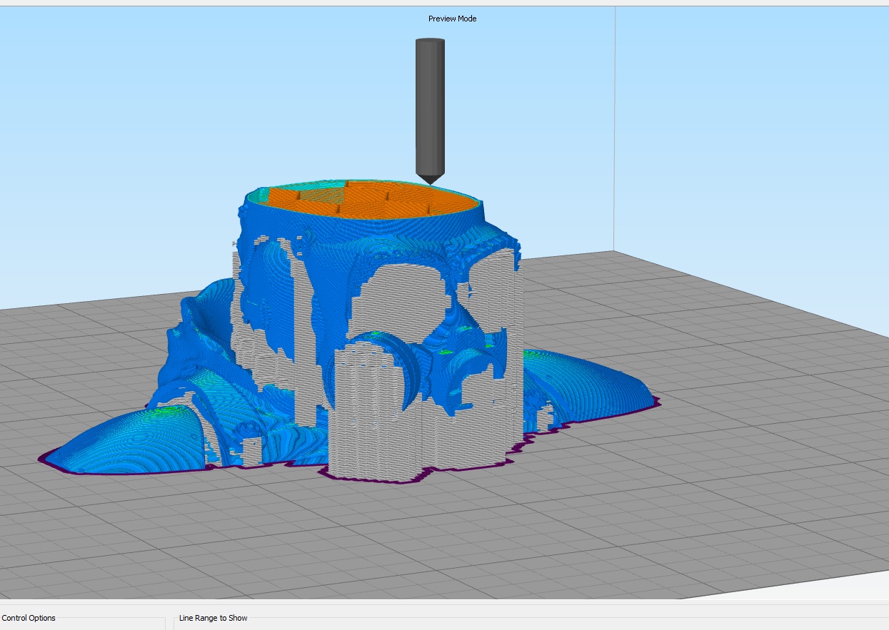 Artem Metro Büstü (Plastik Aparattır!!!)