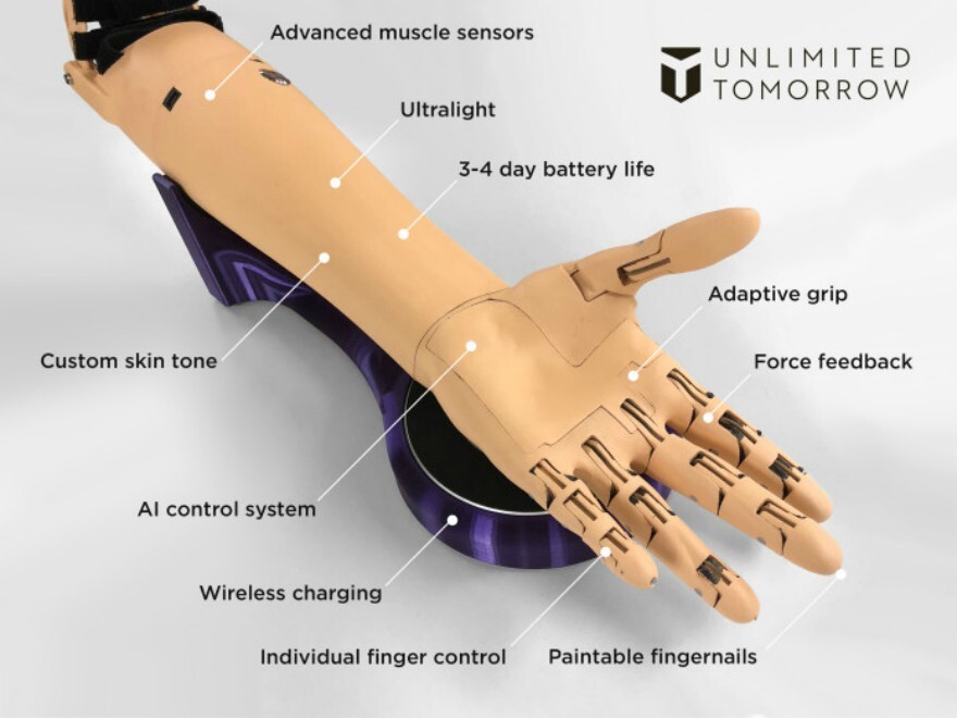 Врач-протезист с бионической рукой